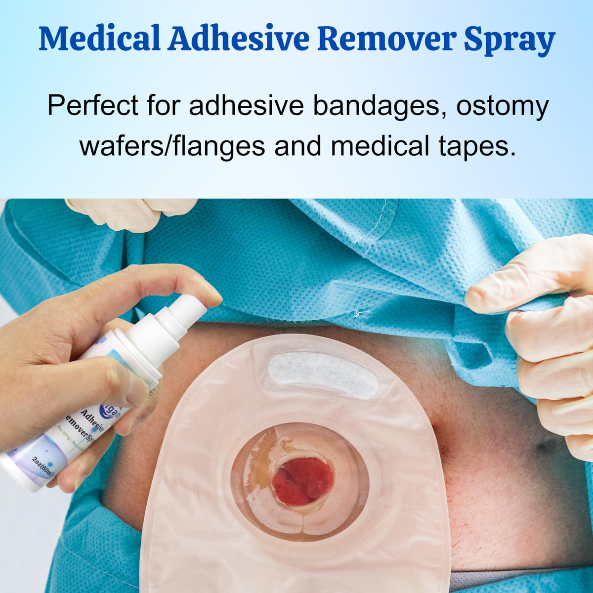 60ml Adhesive Remover Spray E290745
